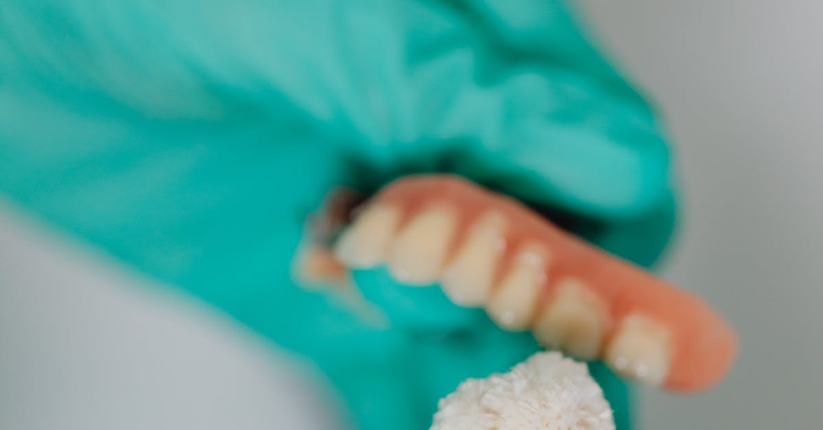 Convenience of Dental Implants Over Traditional Solutions in Turkey  