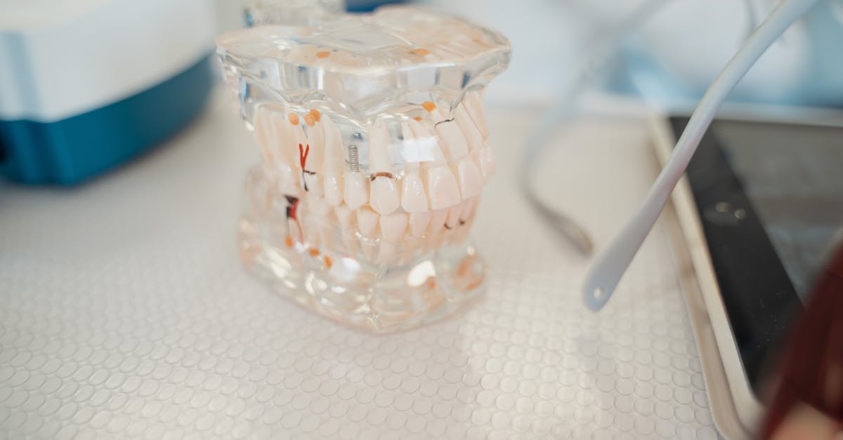 Dental Implants as a Permanent Solution in Turkey  