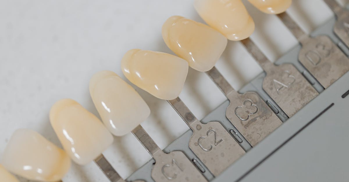 Preventing Teeth Shifting with Dental Implants in Turkey  