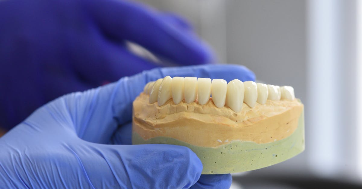 Comprehensive Guide to Dental Implant Costs in Turkey  